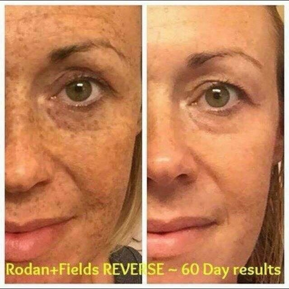 36 Single-Use Rodan+Fields “Reverse” Regimen Samples. For Discoloration. - Picture 5 of 5